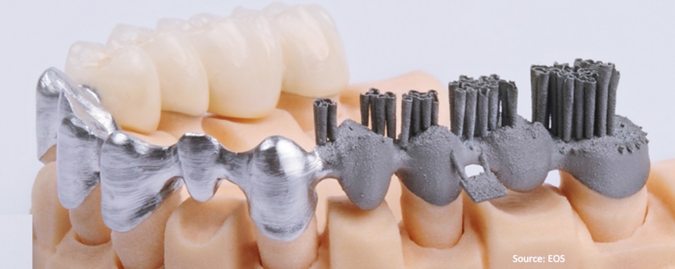 3D печать в производстве зубных имплантов